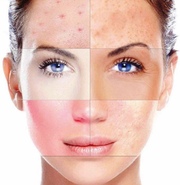 ACADEMIE (Франция): Уход для всех типов кожи с гиппоаллергенными ингредиентами и антивозрастными средствами